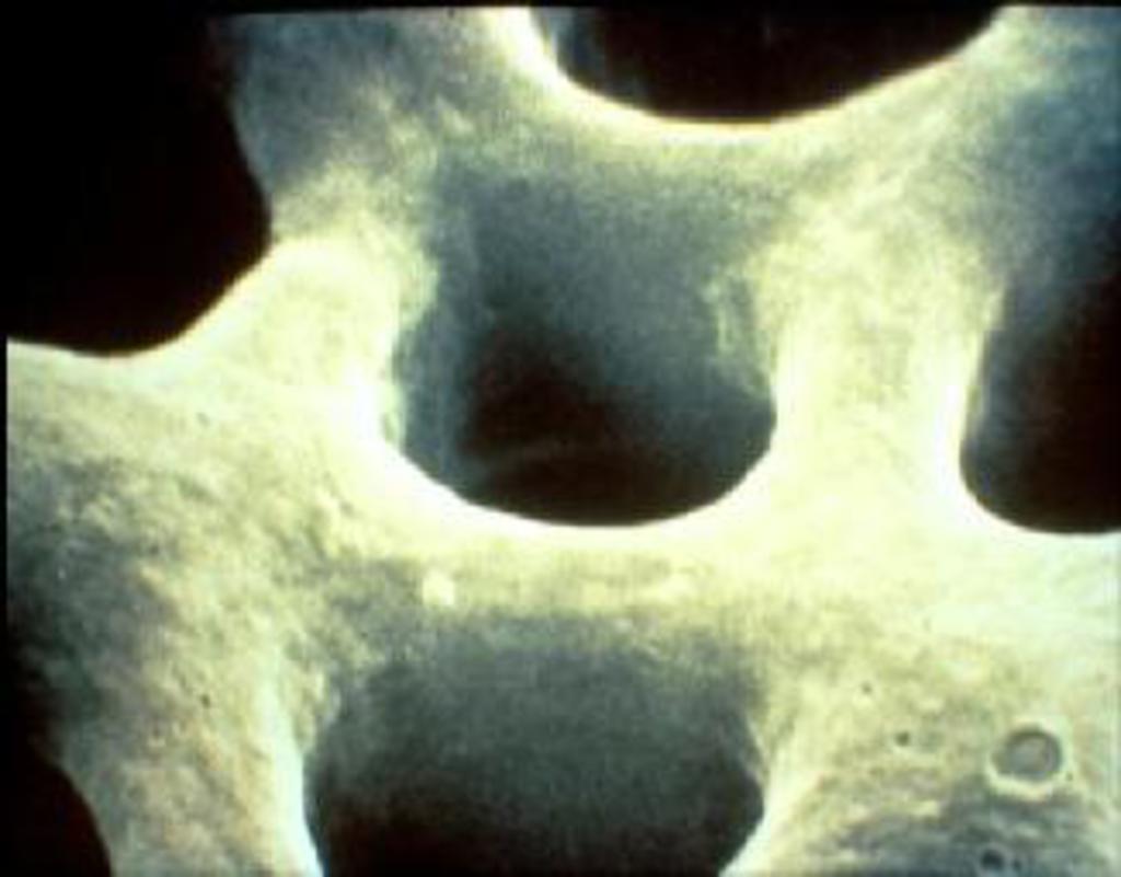 img2